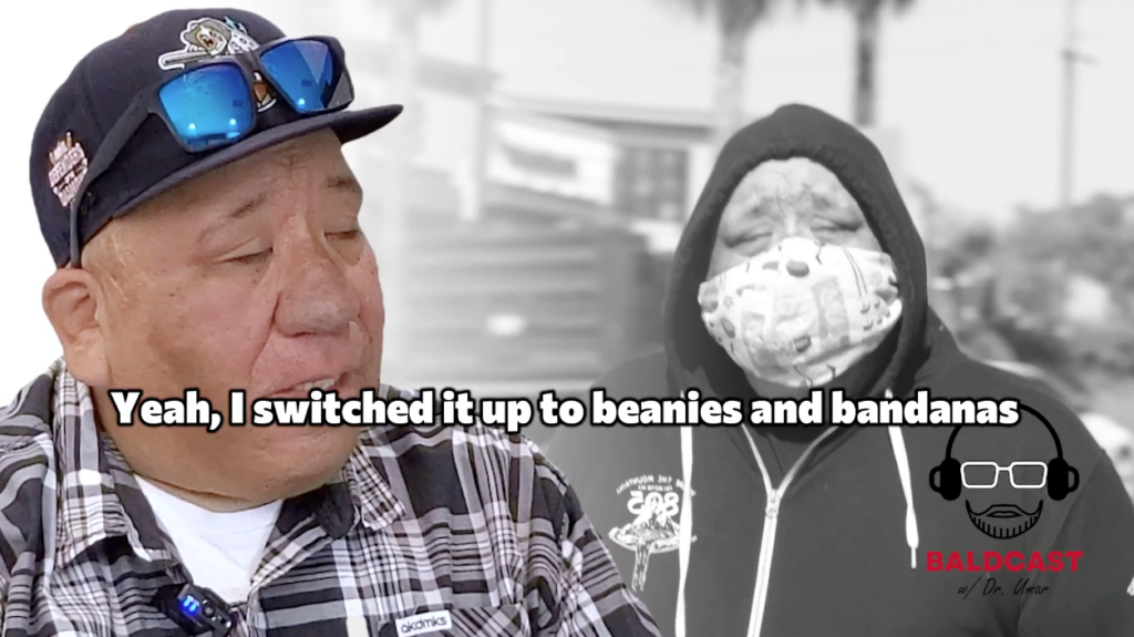 Robert describes how beanies and bandanas became everyday tools for managing life with severe AKN.